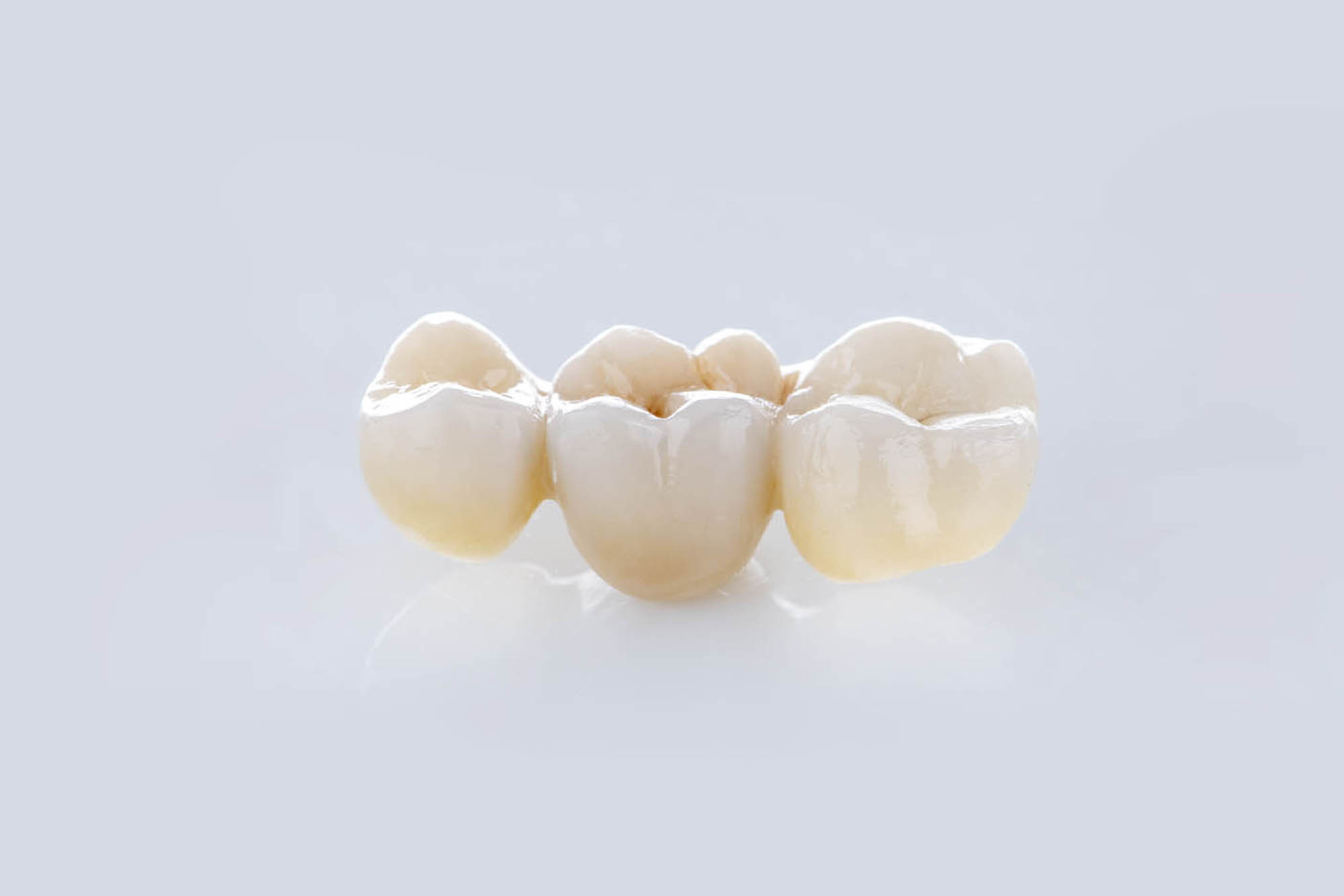mella-tuzzato-studio-dentistico-dolo-venezia-protesi-1